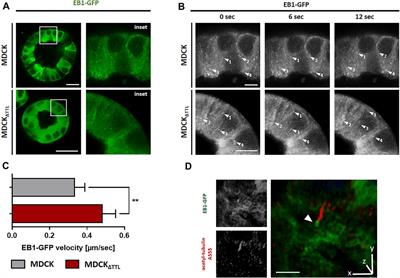 Manipulation of the Tubulin Code Alters Directional Cell Migration and Ciliogenesis